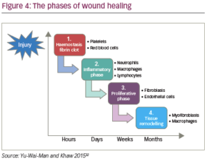 Innovations In The Surgical Management Of Glaucoma - TouchOPHTHALMOLOGY